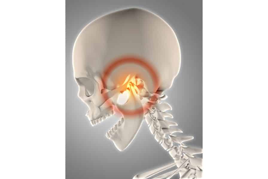 Temporomandibular Joint Disorder