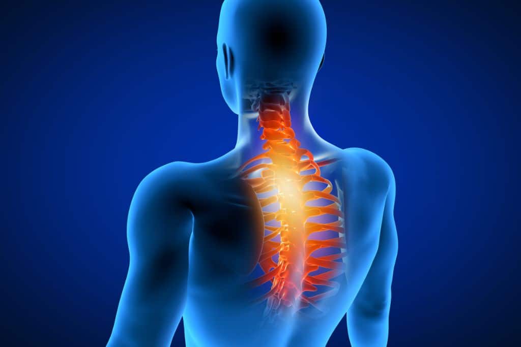 Thoracic radiculopathy