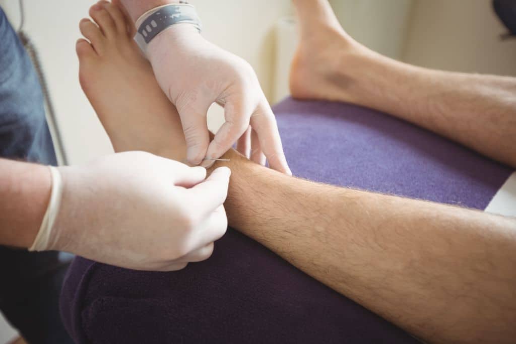 Patient receiving a lower leg nerve exam with a needle electrode, illustrating how would a doctor test for peripheral neuropathy.
